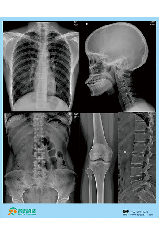 熱敏膠片-DR骨頭四合一.jpg